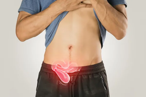 Hernia