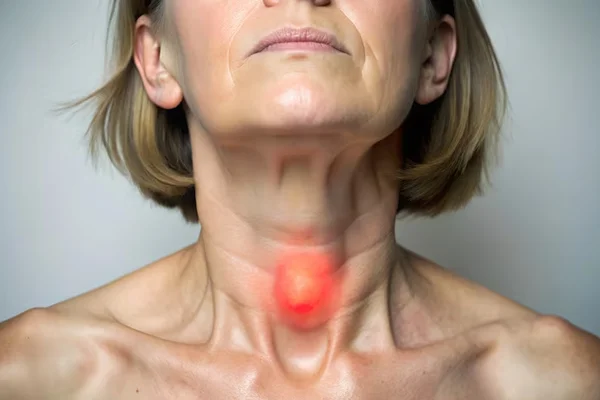 Thyroid Swelling