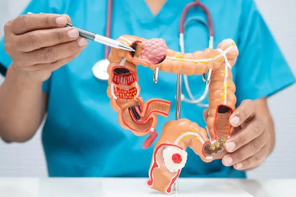 Laser Proctology